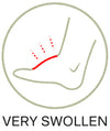Swollen Feet - Severe